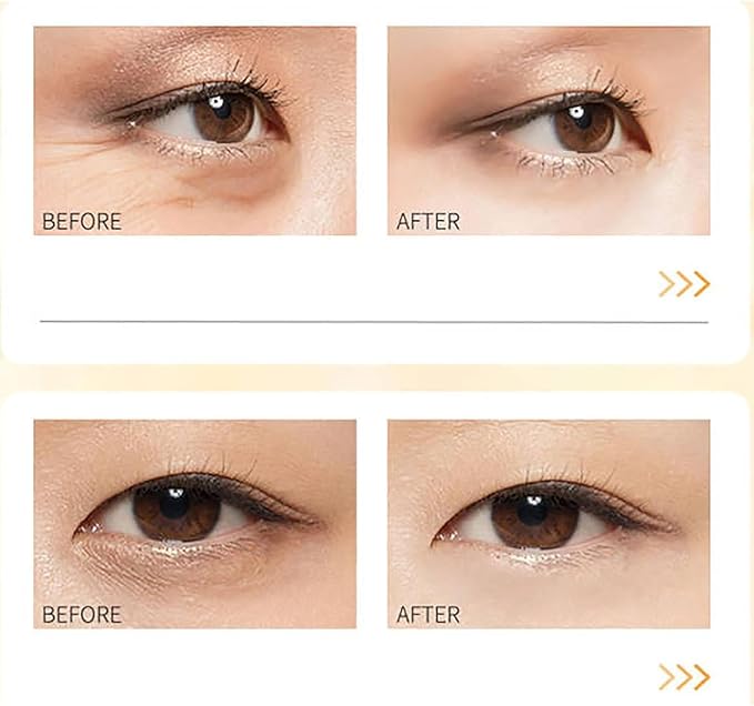 Eye Essence Oil (Pack of 2)